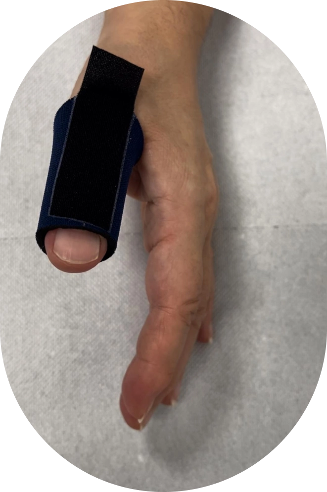 Fisio Functional – tutor dito Fisio Functional - tutor dito